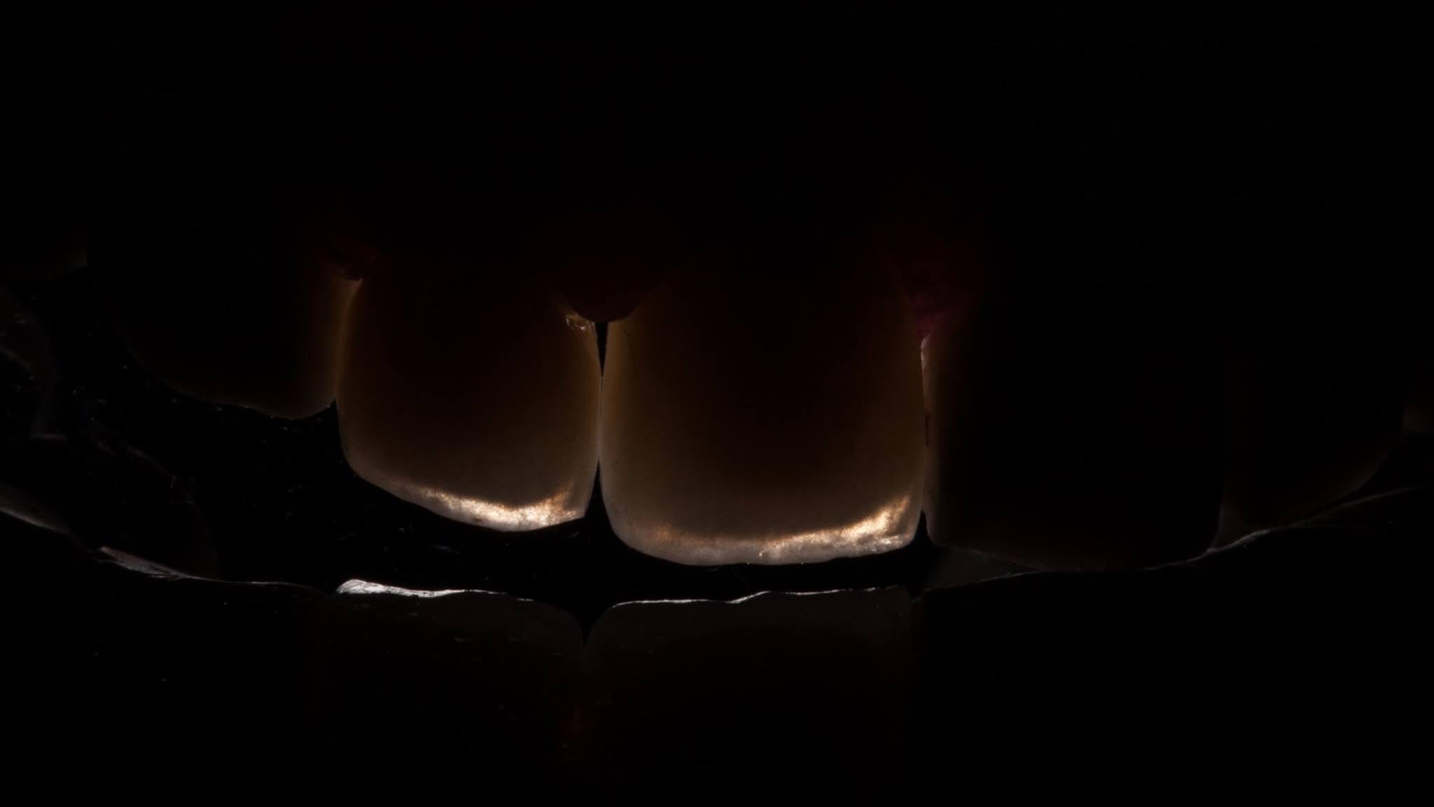 Translucent laminate edges